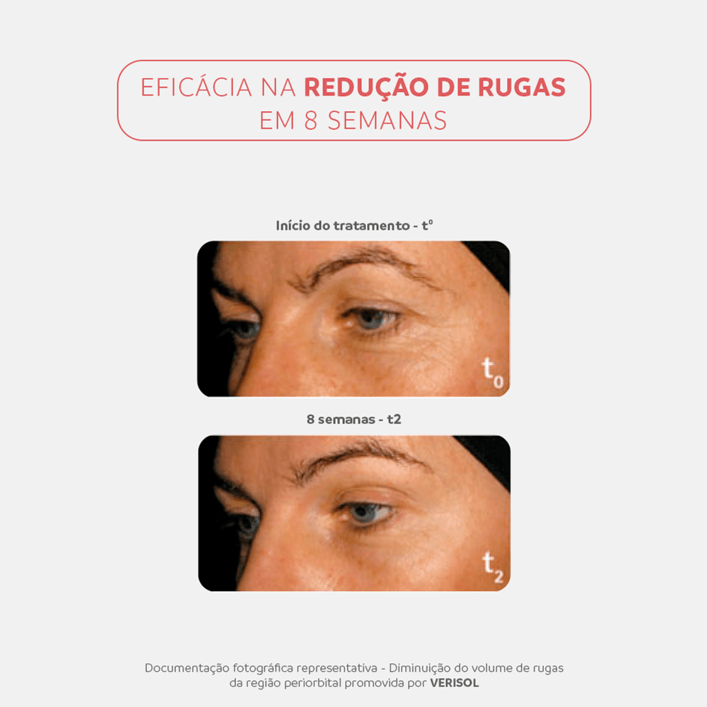 Kit Ineout Collagen Gummies